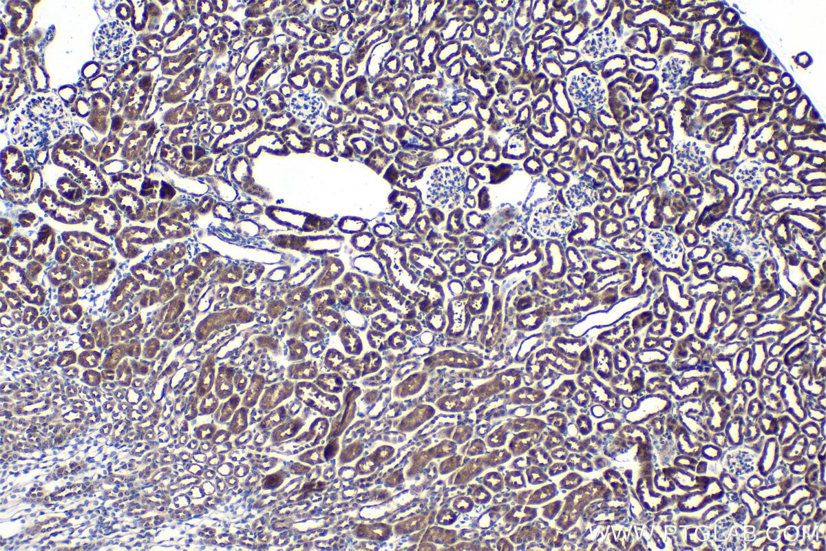 Immunohistochemical analysis of paraffin-embedded mouse kidney tissue slide using KHC1535 (HIVEP1 IHC Kit).