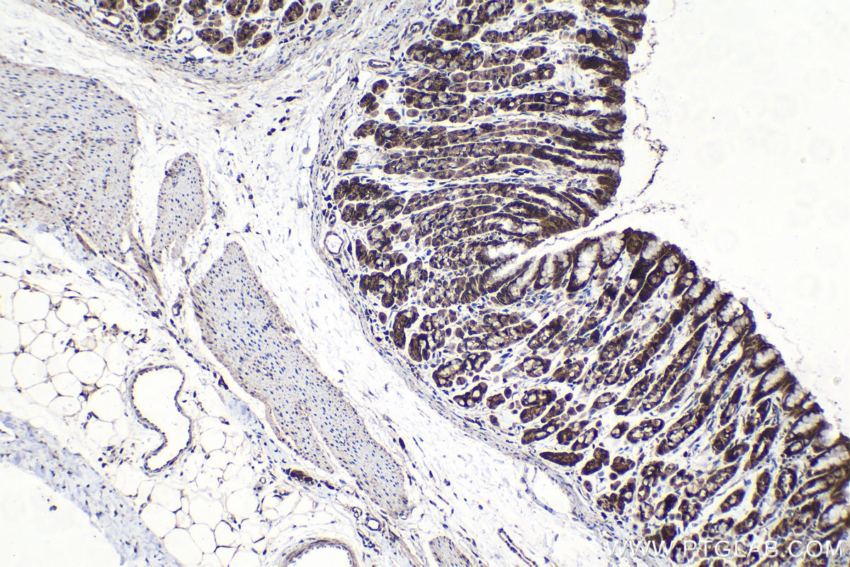 Immunohistochemical analysis of paraffin-embedded rat stomach tissue slide using KHC1535 (HIVEP1 IHC Kit).