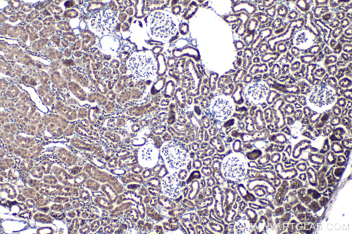 Immunohistochemical analysis of paraffin-embedded rat kidney tissue slide using KHC1535 (HIVEP1 IHC Kit).