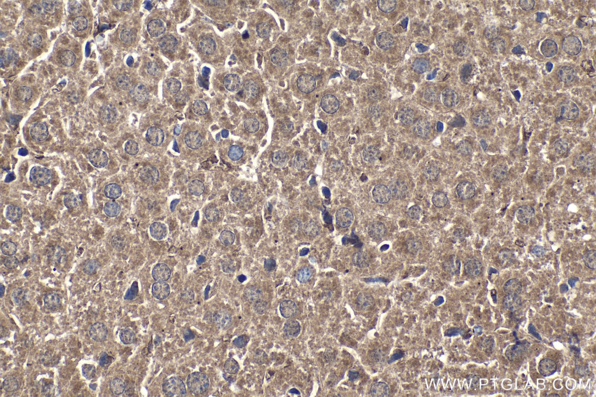 Immunohistochemical analysis of paraffin-embedded mouse liver tissue slide using KHC1535 (HIVEP1 IHC Kit).