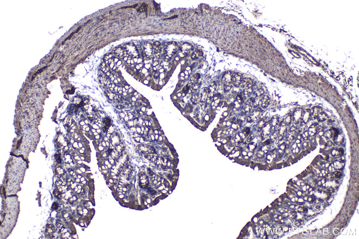 Immunohistochemical analysis of paraffin-embedded mouse colon tissue slide using KHC1109 (HK2 IHC Kit).