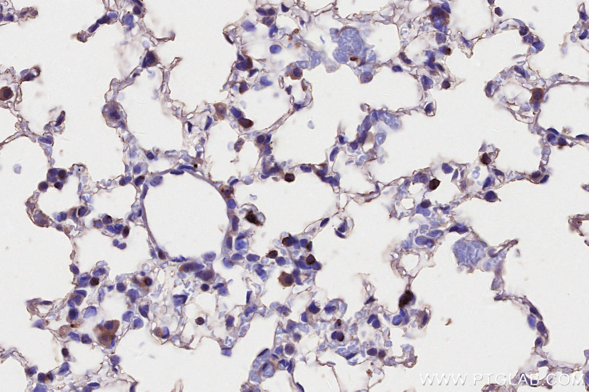 Immunohistochemical analysis of paraffin-embedded mouse lung tissue slide using KHC2757 (HLA-DRA IHC Kit).