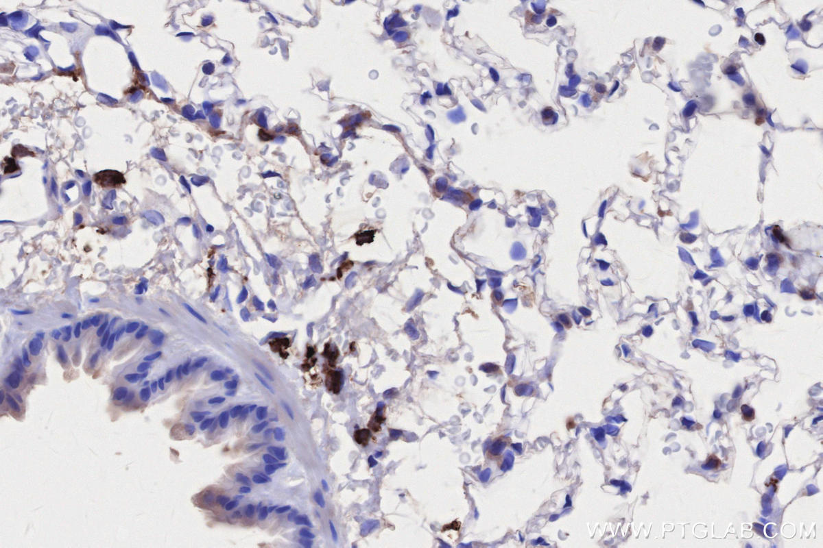 Immunohistochemical analysis of paraffin-embedded rat lung tissue slide using KHC2757 (HLA-DRA IHC Kit).