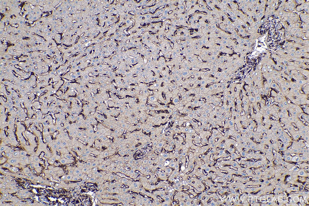 Immunohistochemical analysis of paraffin-embedded human liver tissue slide using KHC0623 (HLA-DRB1 IHC Kit).