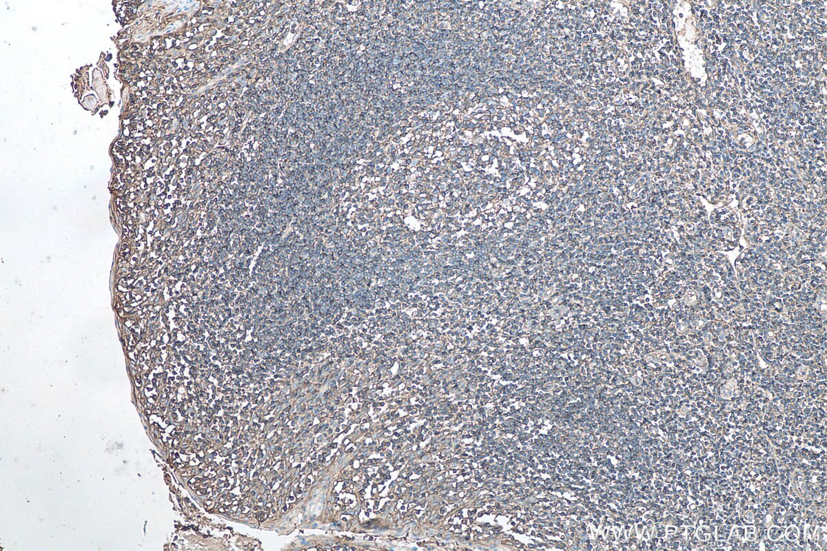 Immunohistochemical analysis of paraffin-embedded human tonsillitis tissue slide using KHC0089 (HLA-E IHC Kit).