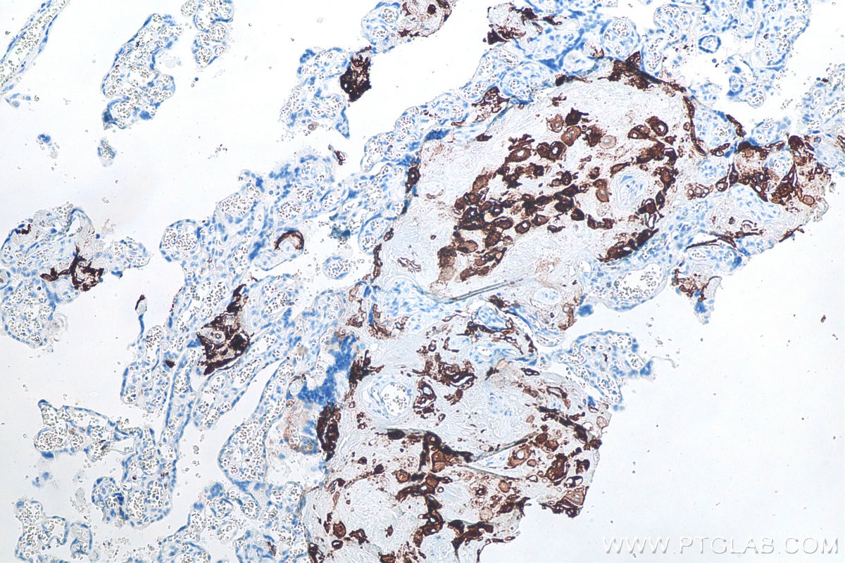 Immunohistochemical analysis of paraffin-embedded human placenta tissue slide using KHC0103 (HLA-G IHC Kit).