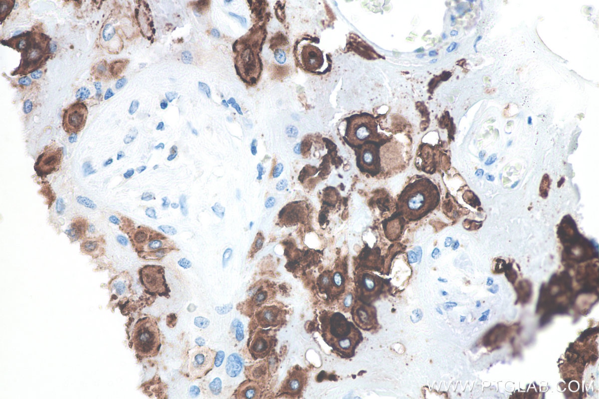 Immunohistochemical analysis of paraffin-embedded human placenta tissue slide using KHC0103 (HLA-G IHC Kit).