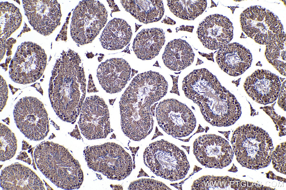 Immunohistochemical analysis of paraffin-embedded mouse testis tissue slide using KHC0265 (HMGA2 IHC Kit).