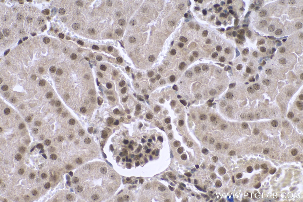 Immunohistochemical analysis of paraffin-embedded mouse kidney tissue slide using KHC0736 (HMGB1 IHC Kit).