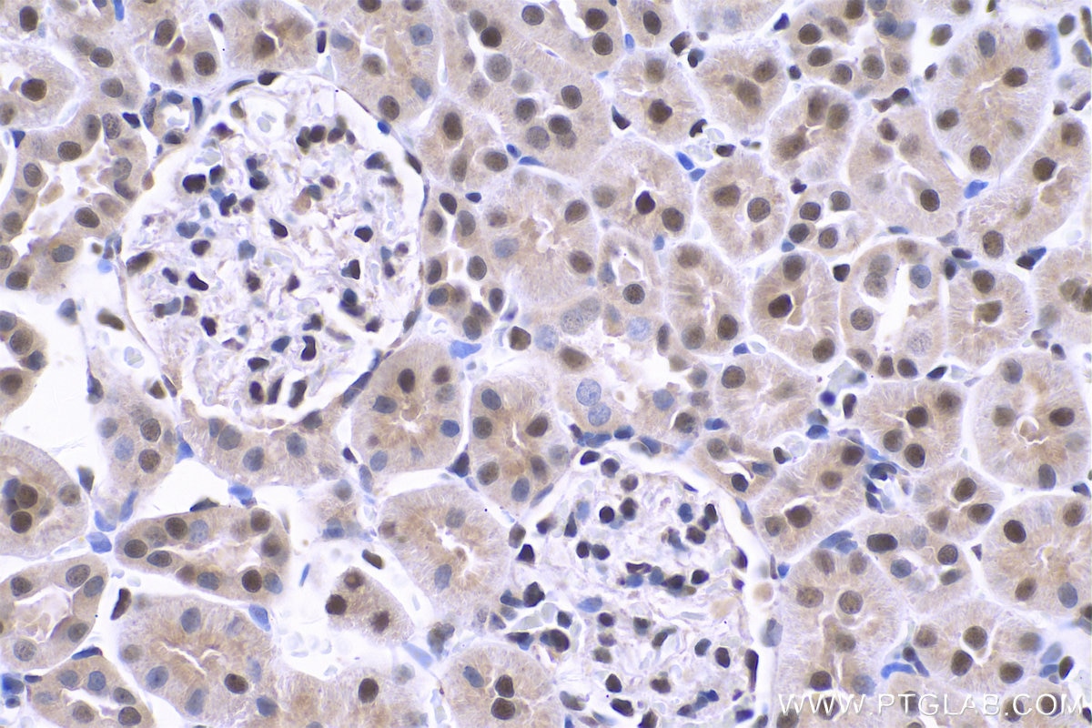 Immunohistochemical analysis of paraffin-embedded rat kidney tissue slide using KHC0736 (HMGB1 IHC Kit).