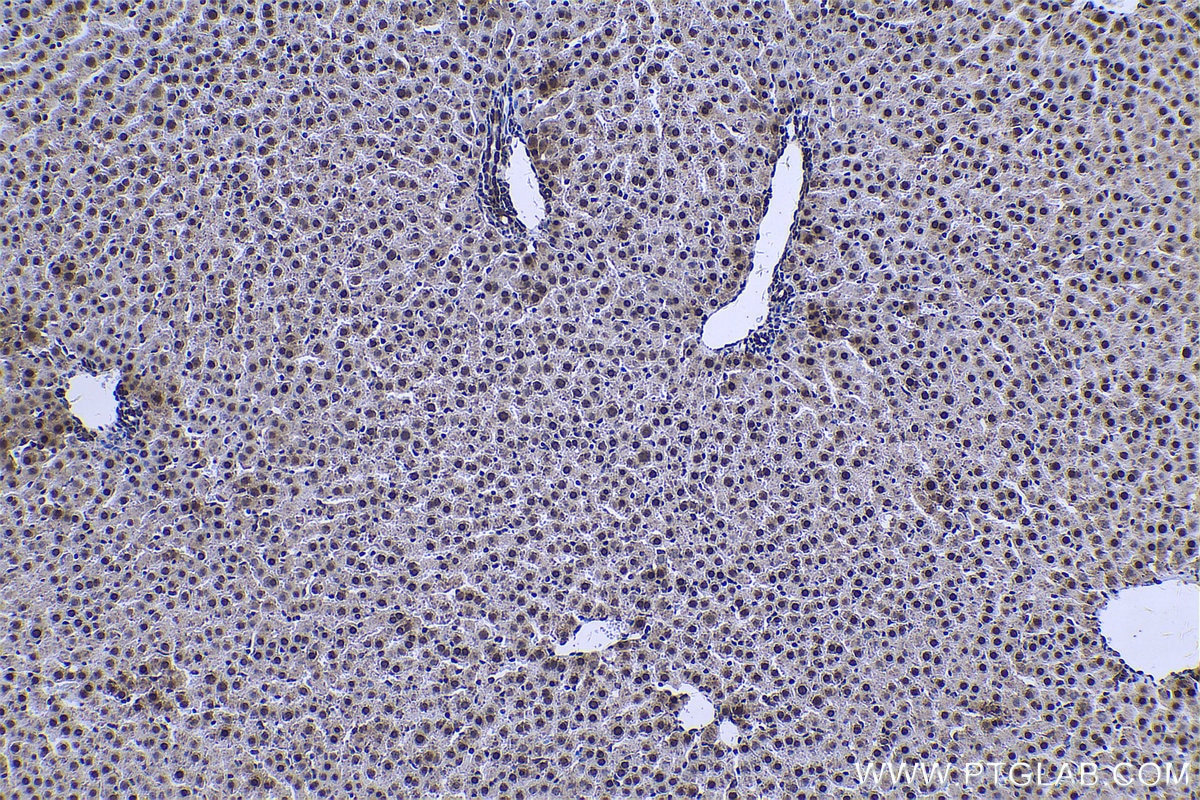 Immunohistochemical analysis of paraffin-embedded rat liver tissue slide using KHC0736 (HMGB1 IHC Kit).