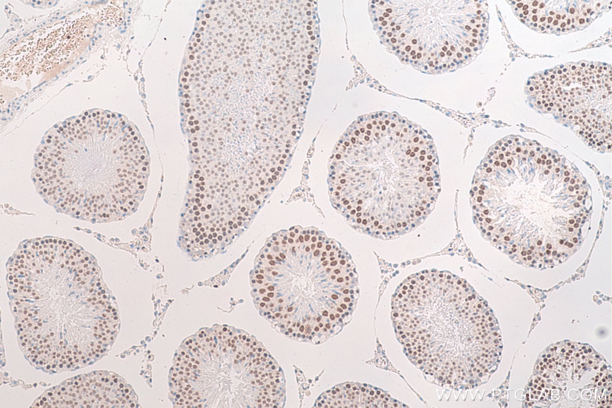 Immunohistochemical analysis of paraffin-embedded rat testis tissue slide using KHC0723 (HMGB2 IHC Kit).
