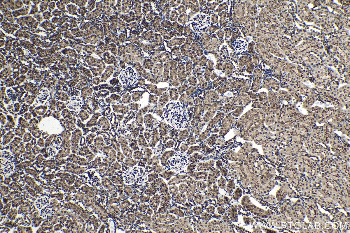 Immunohistochemical analysis of paraffin-embedded rat kidney tissue slide using KHC1410 (HMGN1 IHC Kit).