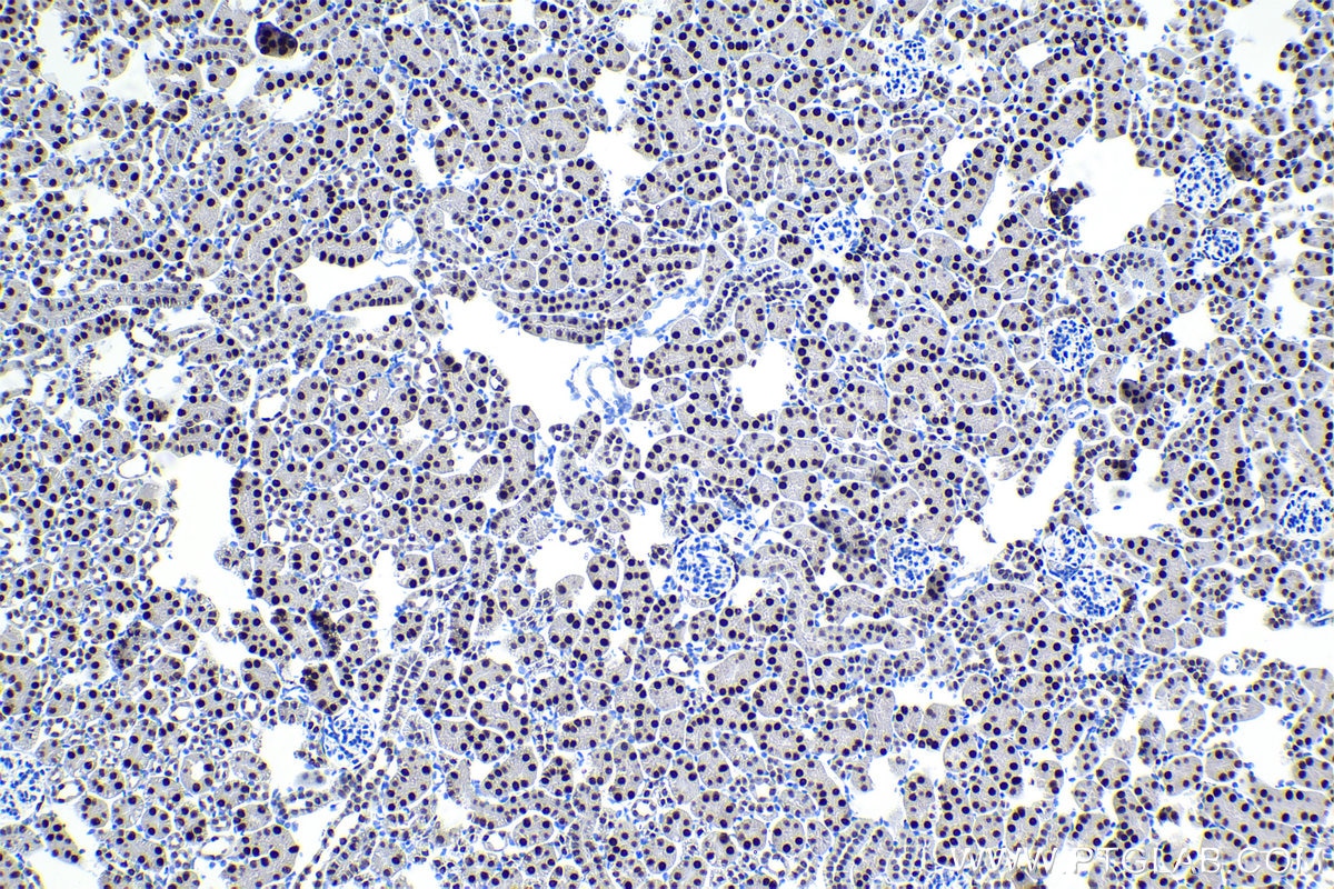 Immunohistochemical analysis of paraffin-embedded mouse kidney tissue slide using KHC1100 (HNF1B IHC Kit).