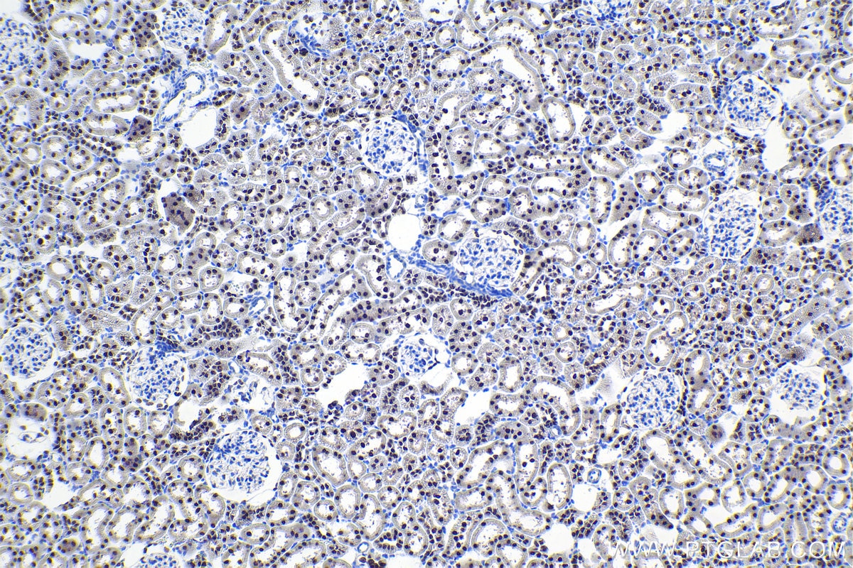 Immunohistochemical analysis of paraffin-embedded rat kidney tissue slide using KHC1100 (HNF1B IHC Kit).