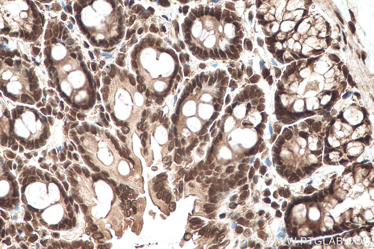 Immunohistochemical analysis of paraffin-embedded rat colon tissue slide using KHC0682 (HNRNPA1 IHC Kit).