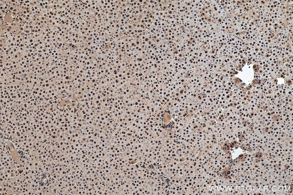 Immunohistochemical analysis of paraffin-embedded rat liver tissue slide using KHC0682 (HNRNPA1 IHC Kit).