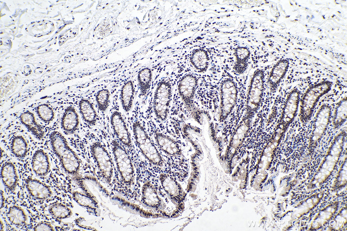 Immunohistochemical analysis of paraffin-embedded human colon tissue slide using KHC0163 (HNRNPA2B1 IHC Kit).
