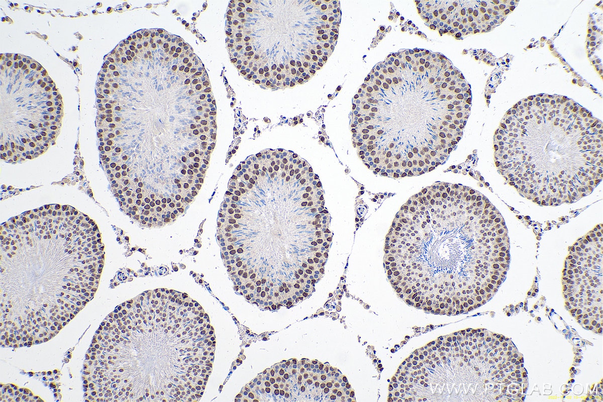 Immunohistochemical analysis of paraffin-embedded rat testis tissue slide using KHC0657 (HNRNPA3 IHC Kit).