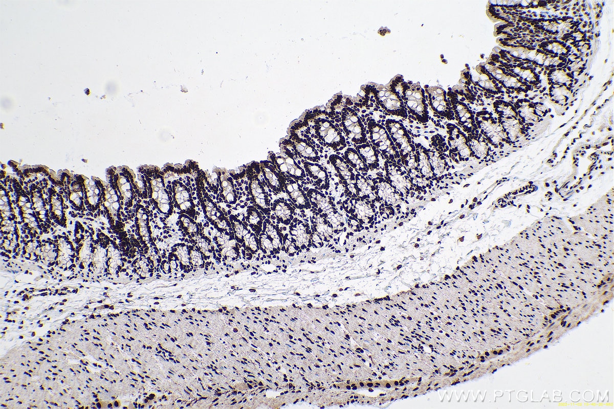 Immunohistochemical analysis of paraffin-embedded rat colon tissue slide using KHC0657 (HNRNPA3 IHC Kit).