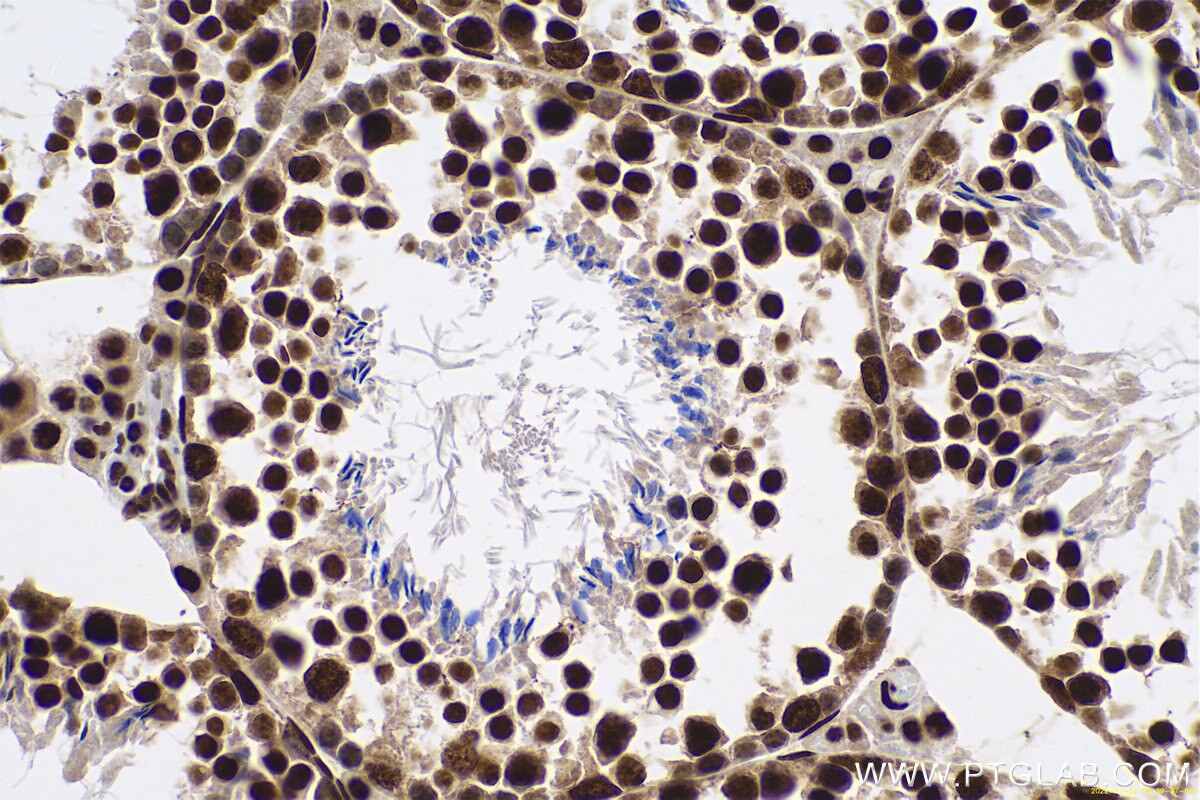 Immunohistochemical analysis of paraffin-embedded mouse testis tissue slide using KHC0657 (HNRNPA3 IHC Kit).
