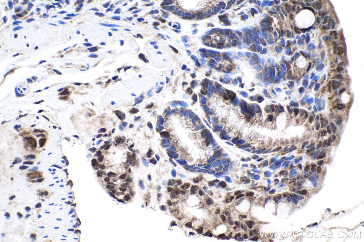 Immunohistochemical analysis of paraffin-embedded mouse colon tissue slide using KHC0164 (HNRNPC IHC Kit).