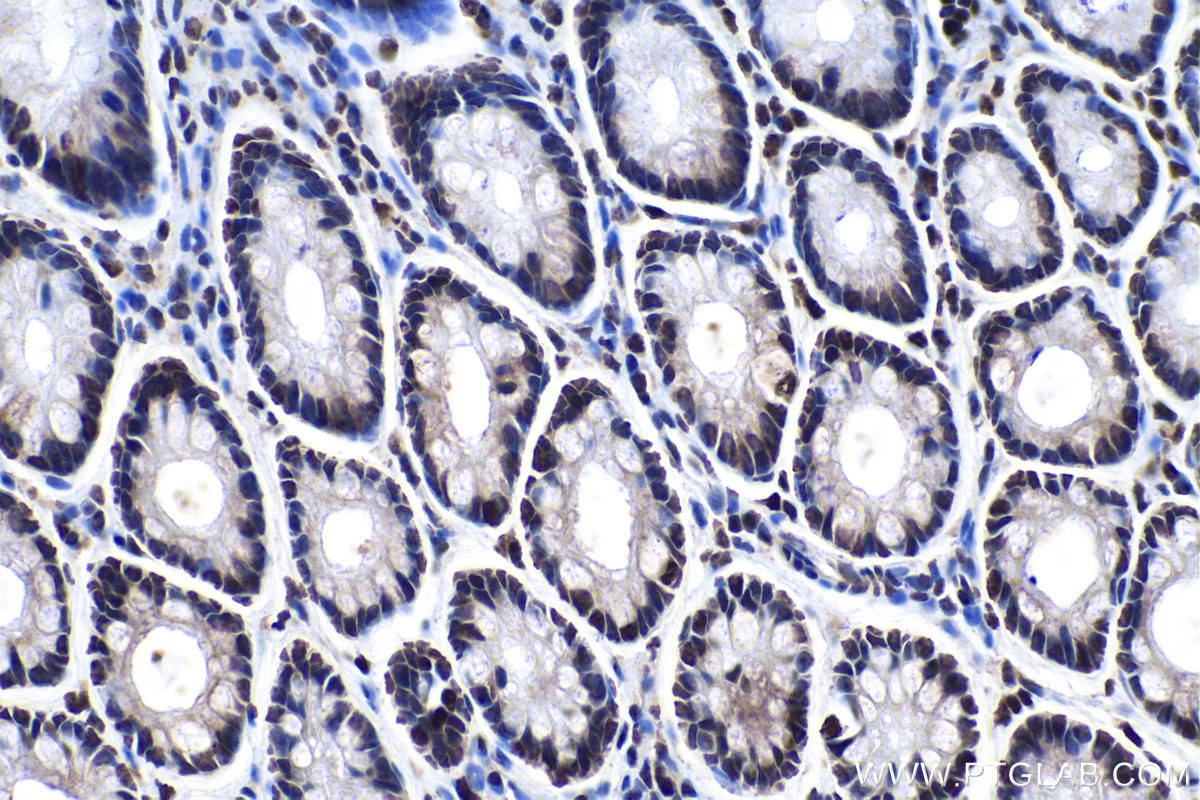 Immunohistochemical analysis of paraffin-embedded rat colon tissue slide using KHC0164 (HNRNPC IHC Kit).