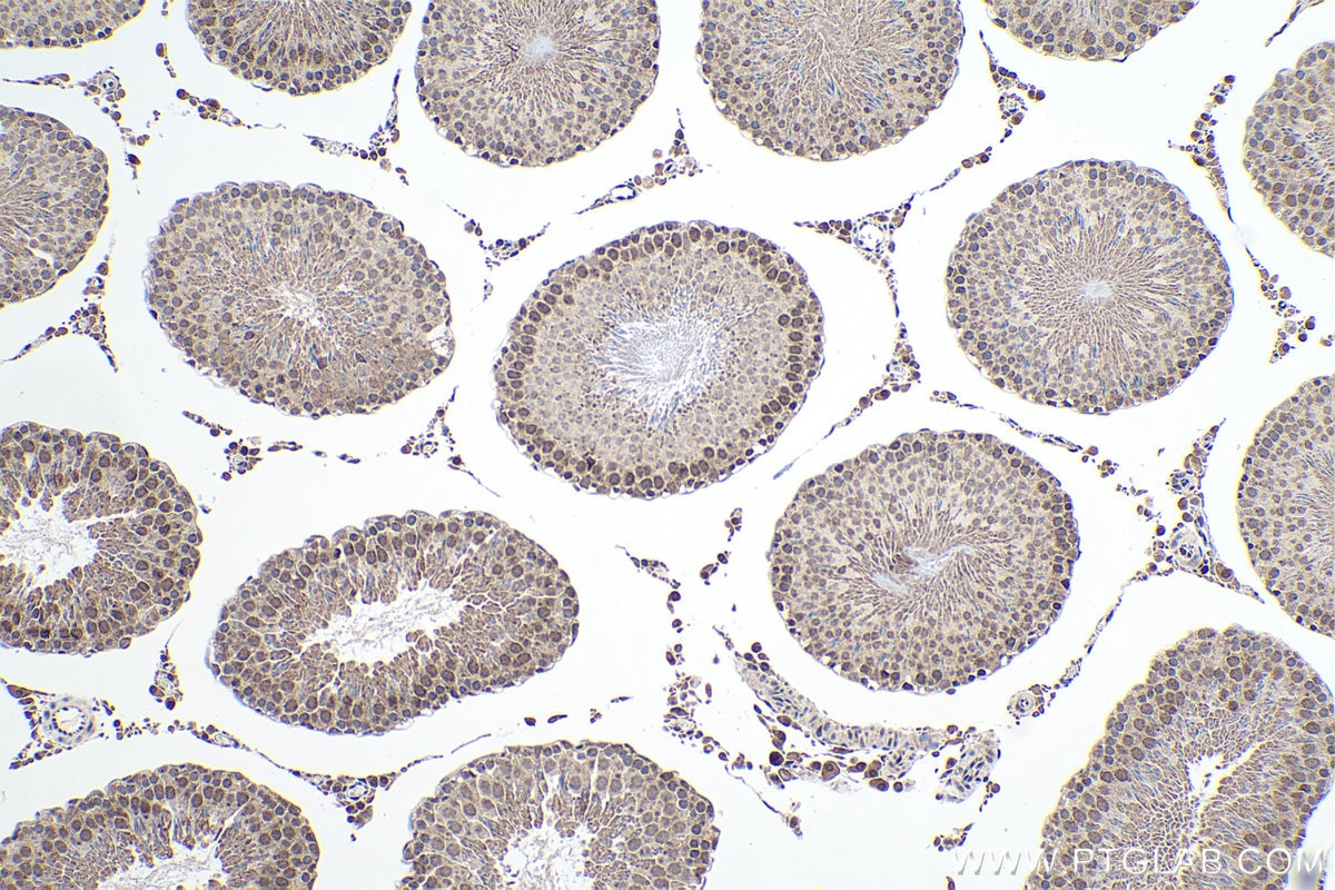 Immunohistochemical analysis of paraffin-embedded rat testis tissue slide using KHC0164 (HNRNPC IHC Kit).