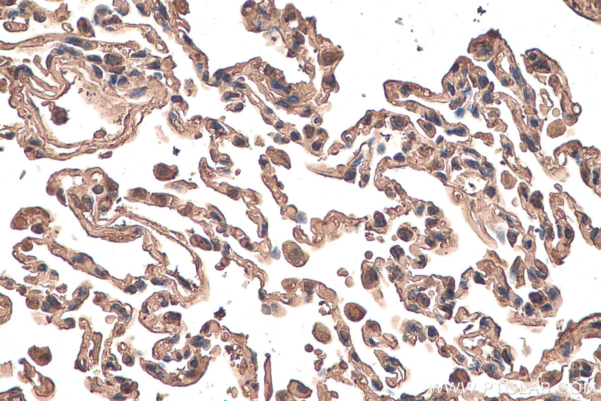 Immunohistochemical analysis of paraffin-embedded human lung tissue slide using KHC0590 (HNRNPK IHC Kit).