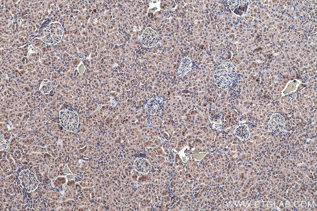 Immunohistochemical analysis of paraffin-embedded rat kidney tissue slide using KHC0590 (HNRNPK IHC Kit).