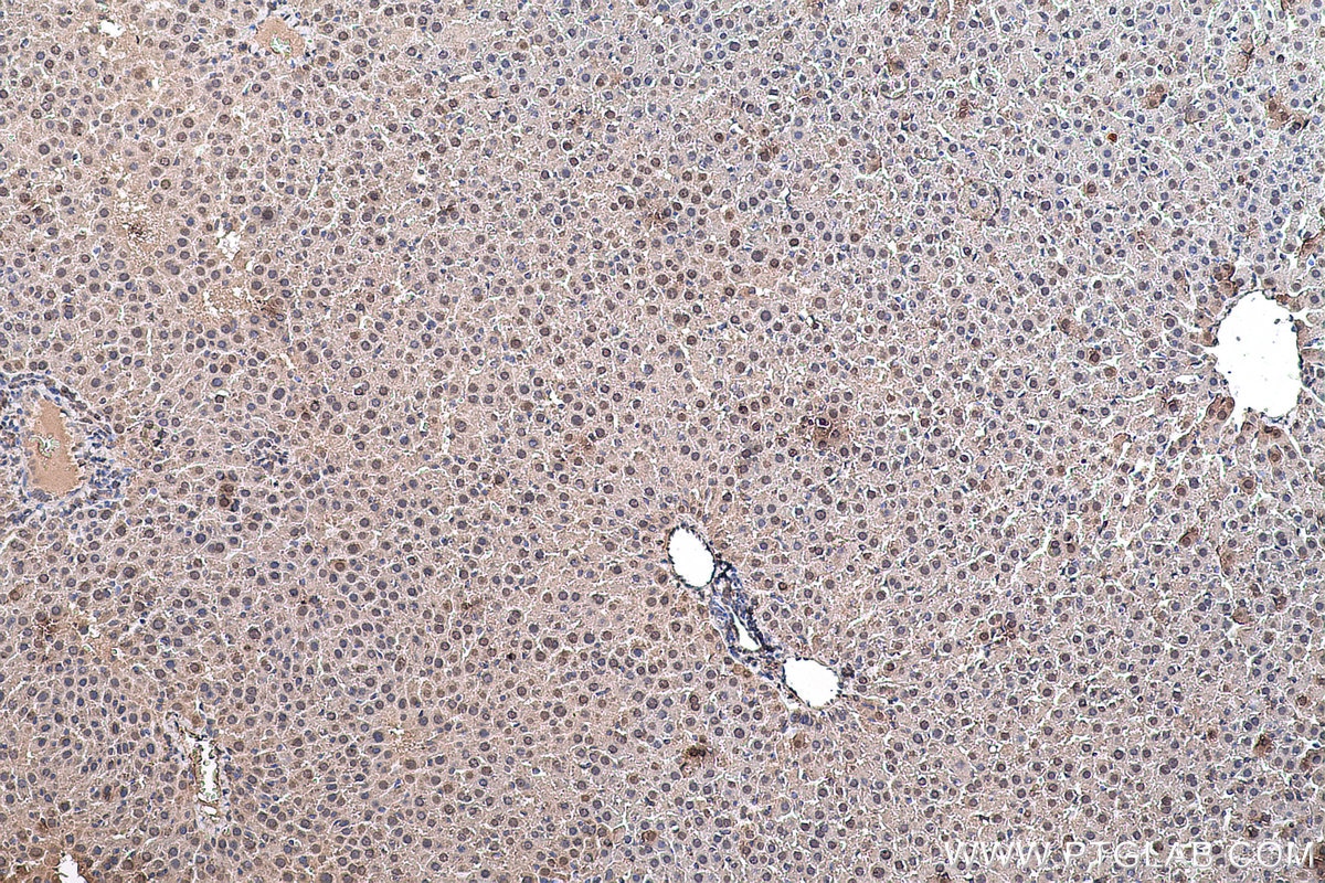 Immunohistochemical analysis of paraffin-embedded rat liver tissue slide using KHC0590 (HNRNPK IHC Kit).