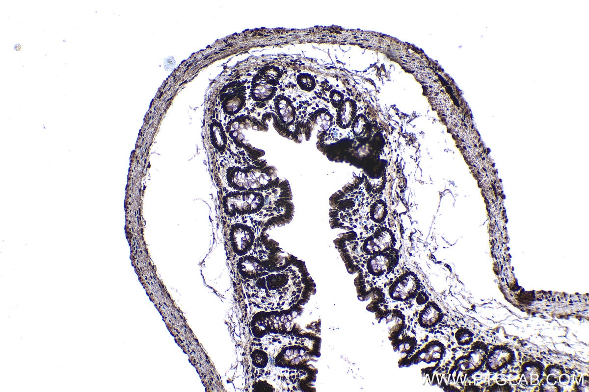 Immunohistochemical analysis of paraffin-embedded rat colon tissue slide using KHC1386 (HNRNPL IHC Kit).