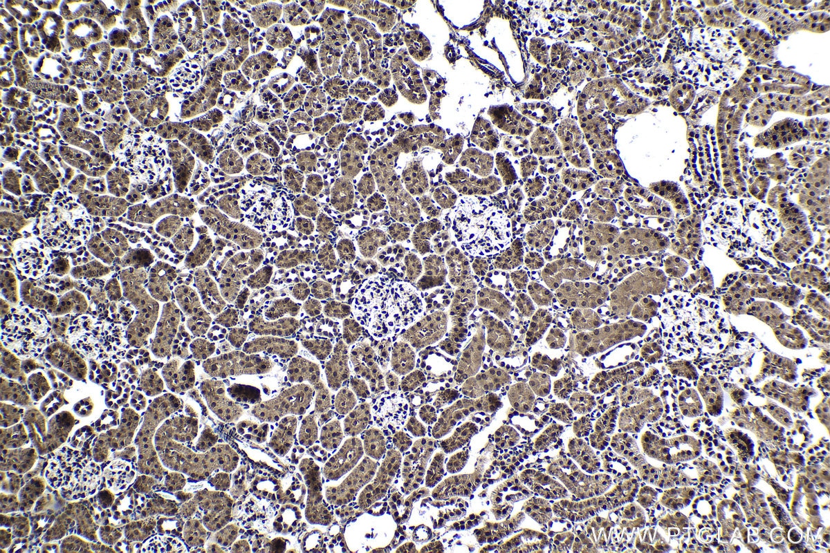 Immunohistochemical analysis of paraffin-embedded rat kidney tissue slide using KHC1386 (HNRNPL IHC Kit).