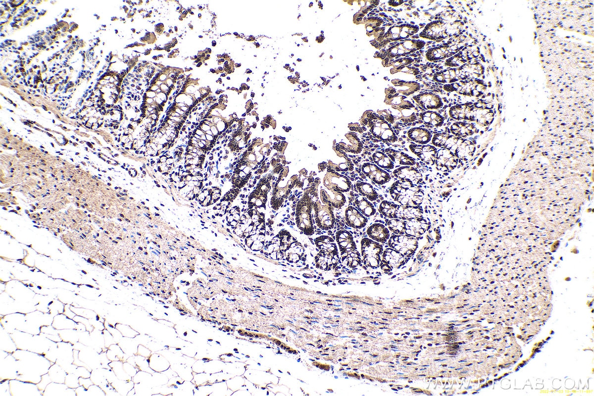 Immunohistochemical analysis of paraffin-embedded rat colon tissue slide using KHC0669 (HNRNPU IHC Kit).