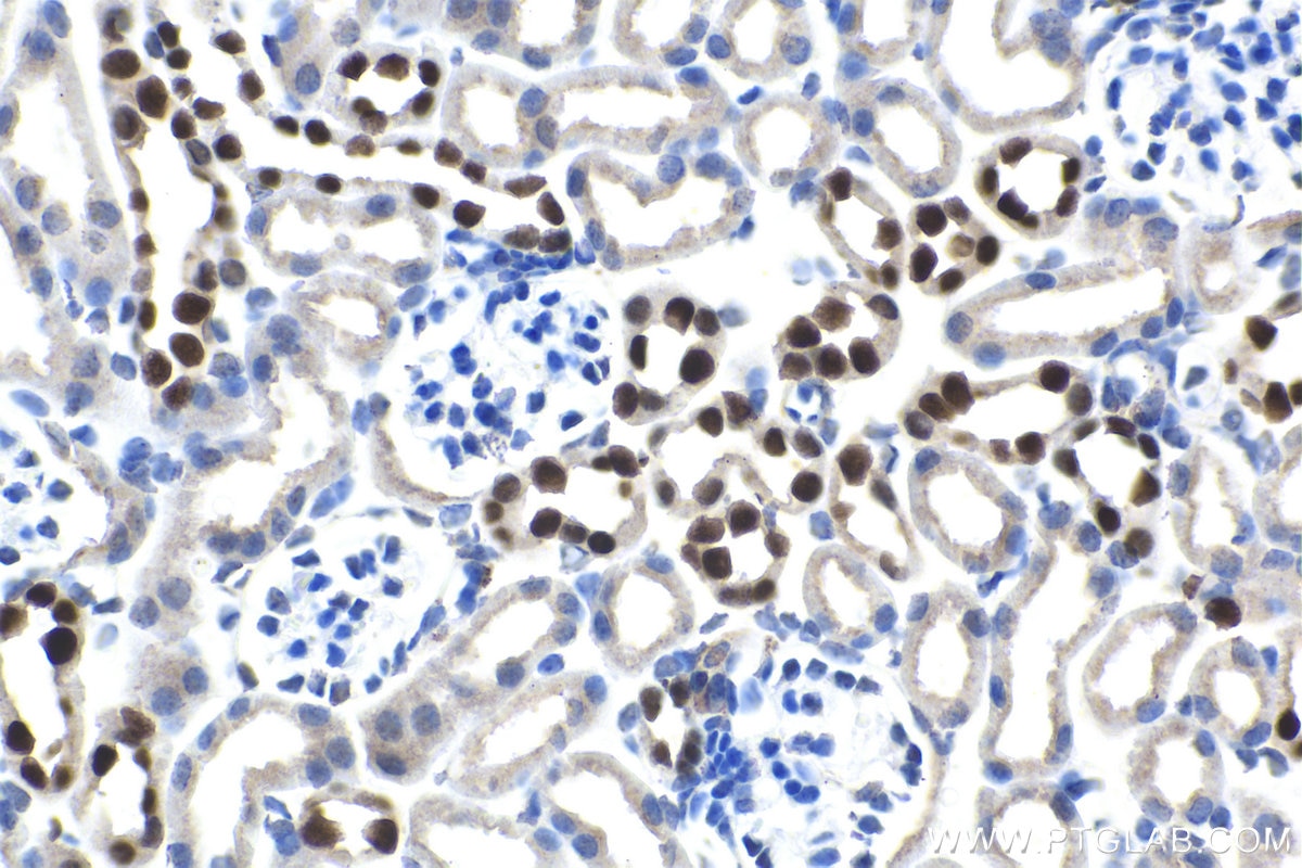 Immunohistochemical analysis of paraffin-embedded mouse kidney tissue slide using KHC1529 (HOXD8 IHC Kit).