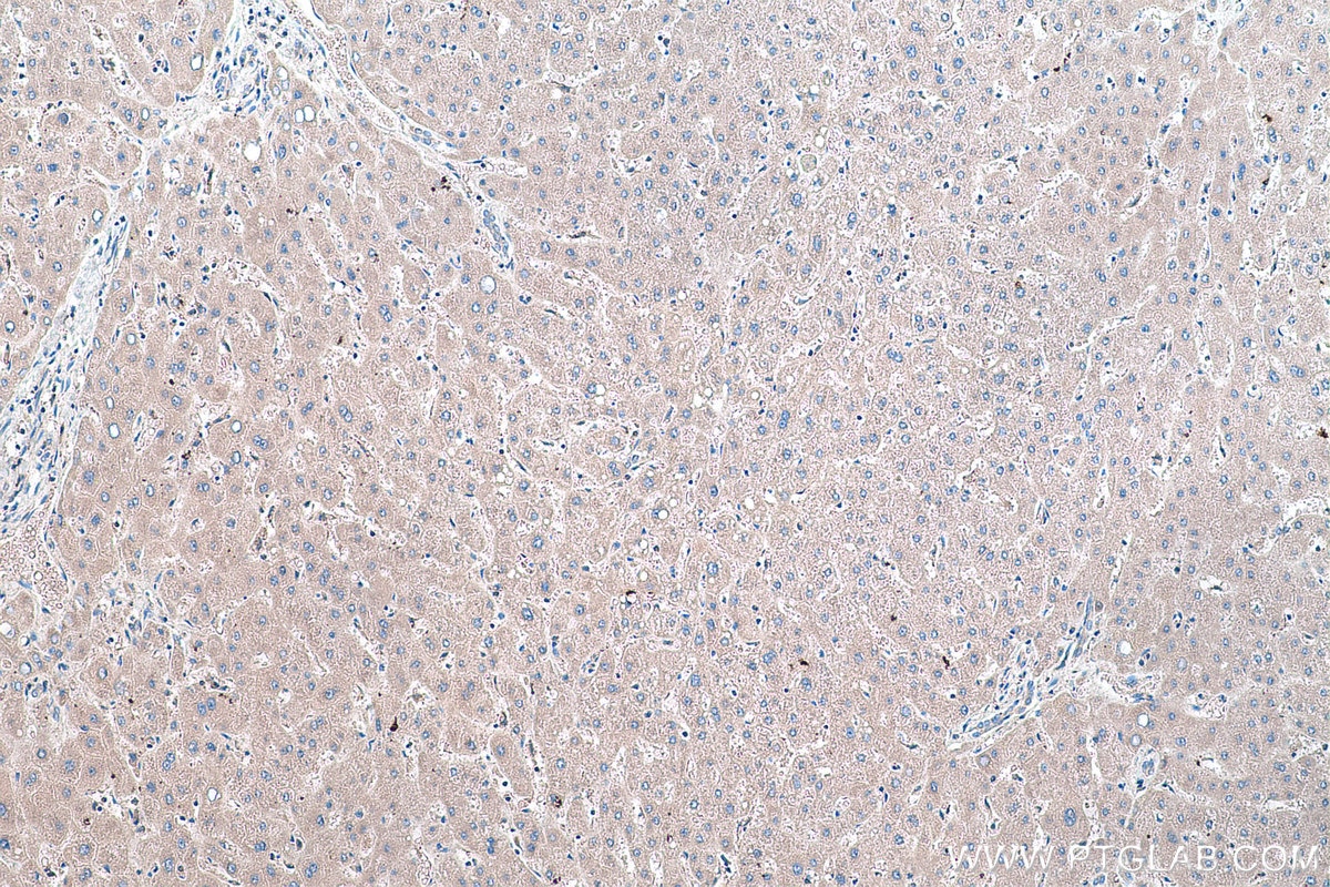 Immunohistochemical analysis of paraffin-embedded human liver tissue slide using KHC0426 (HPRT1 IHC Kit).