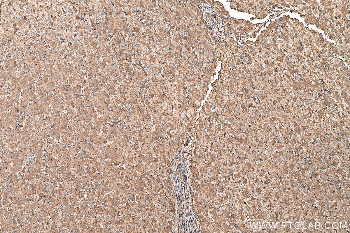 Immunohistochemical analysis of paraffin-embedded human liver tissue slide using KHC0673 (HPX IHC Kit).