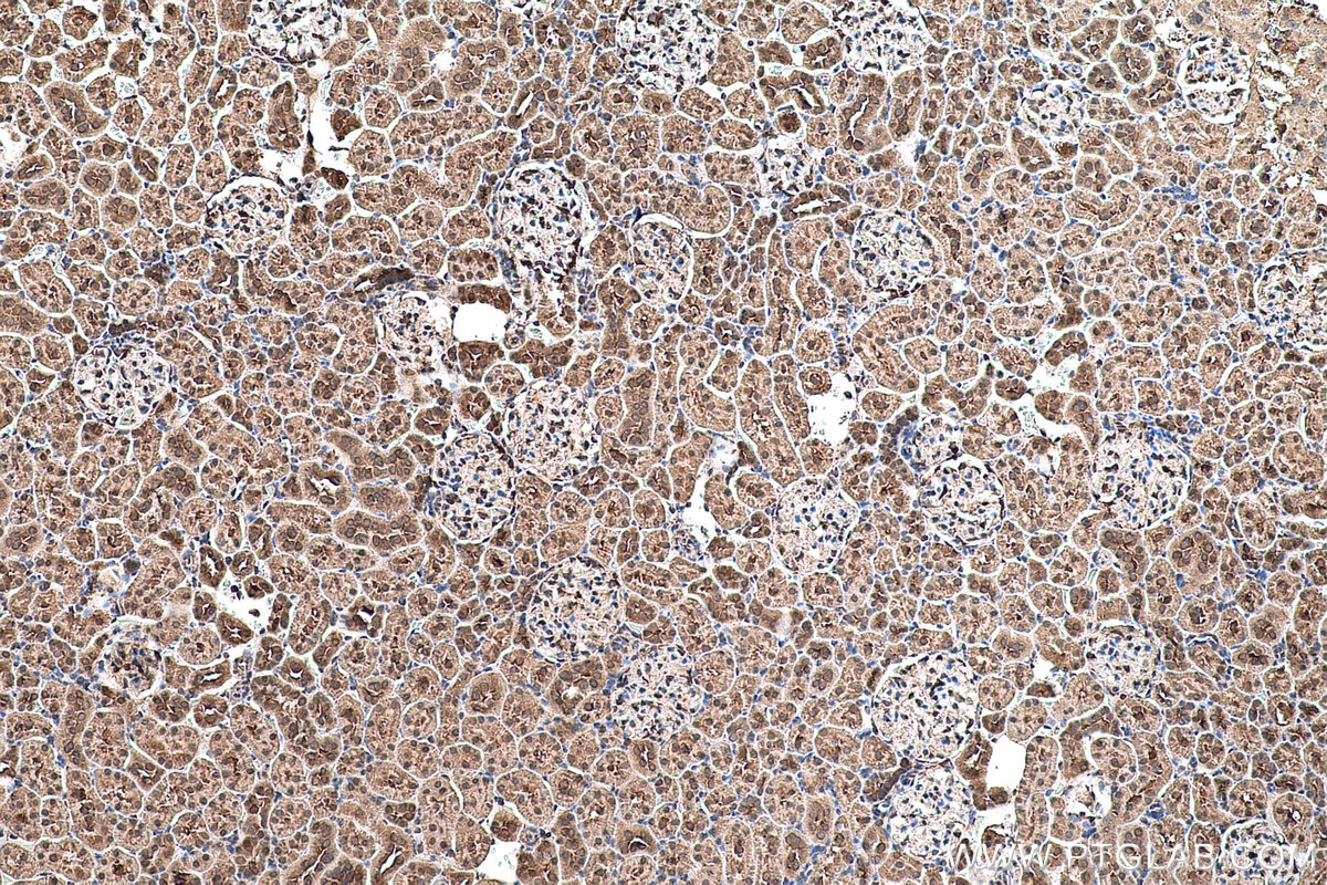 Immunohistochemical analysis of paraffin-embedded rat kidney tissue slide using KHC0549 (Hsc70 IHC Kit).