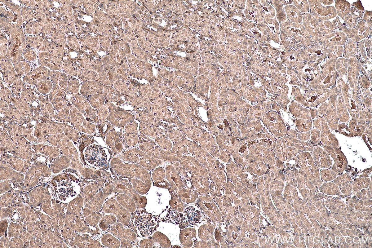 Immunohistochemical analysis of paraffin-embedded mouse kidney tissue slide using KHC0549 (Hsc70 IHC Kit).