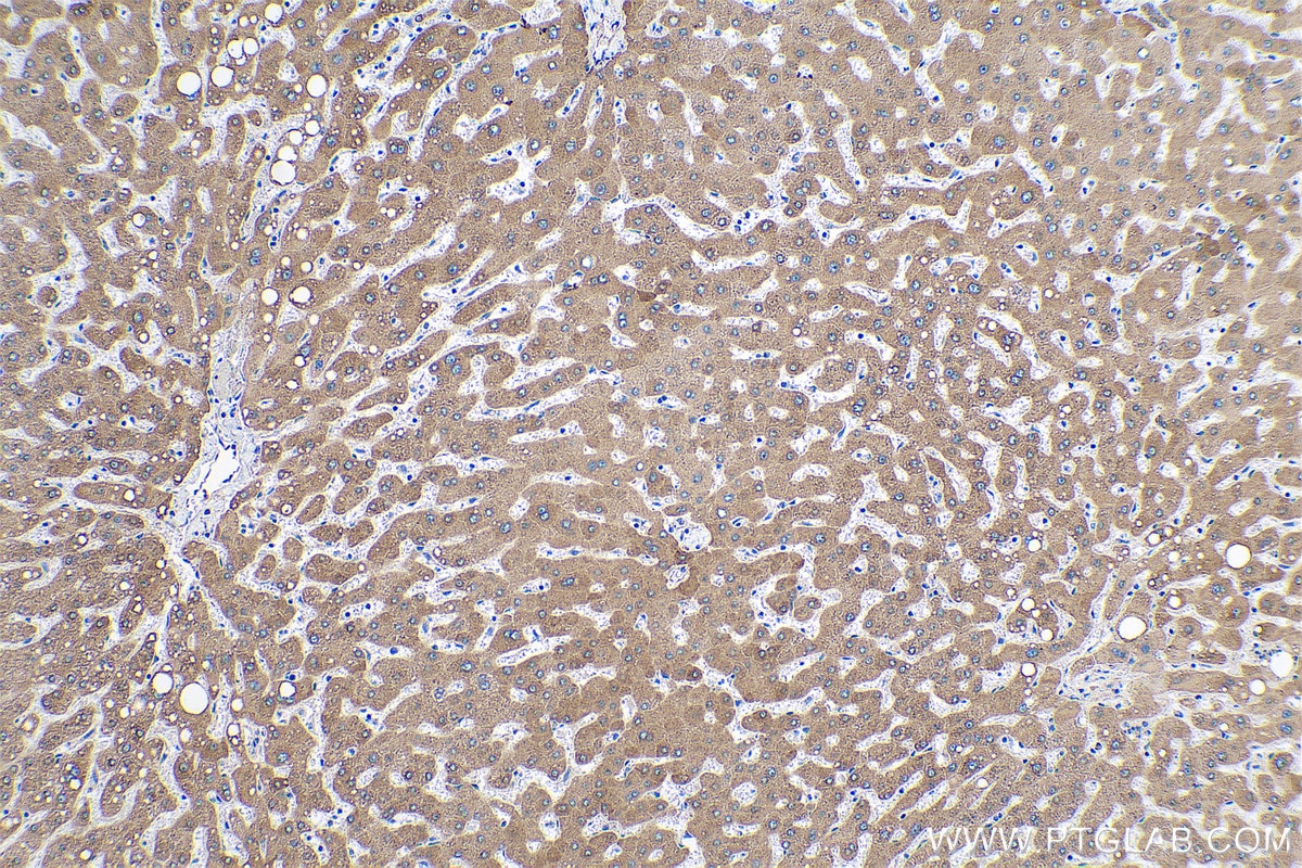 Immunohistochemical analysis of paraffin-embedded human liver tissue slide using KHC0625 (HSD17B2 IHC Kit).