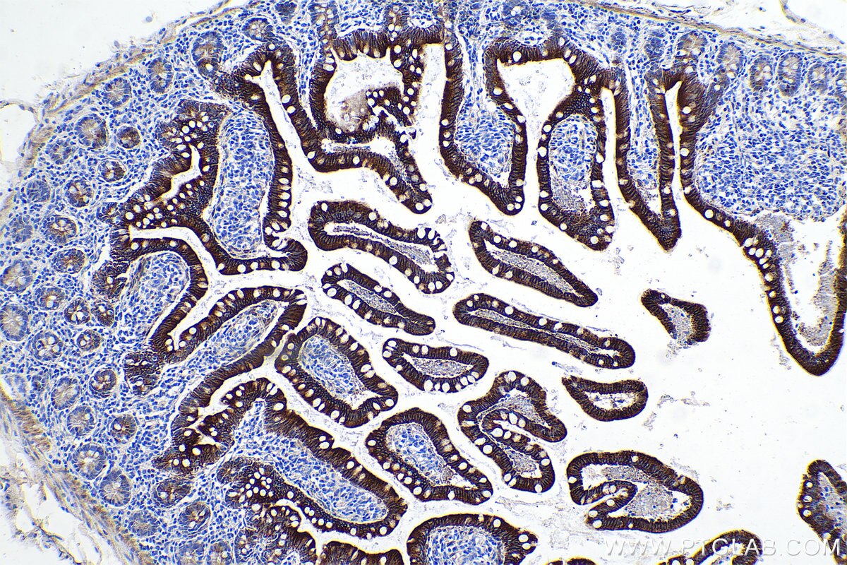 Immunohistochemical analysis of paraffin-embedded human small intestine tissue slide using KHC0625 (HSD17B2 IHC Kit).