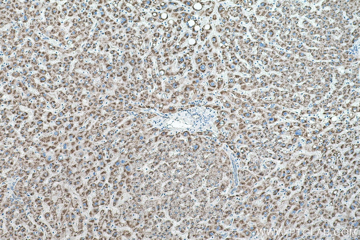 Immunohistochemical analysis of paraffin-embedded human liver tissue slide using KHC0573 (HSD17B4 IHC Kit).