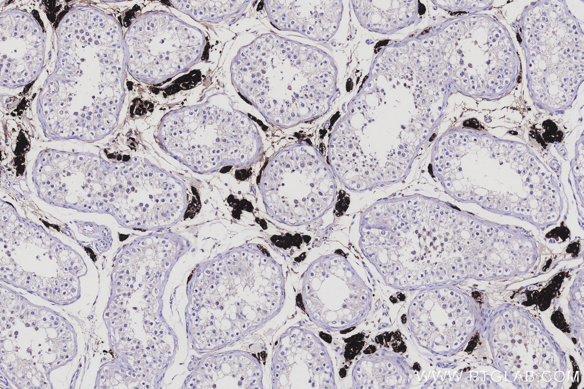 Immunohistochemical analysis of paraffin-embedded human testis tissue slide using KHC3136 (HSD17B6 IHC Kit).