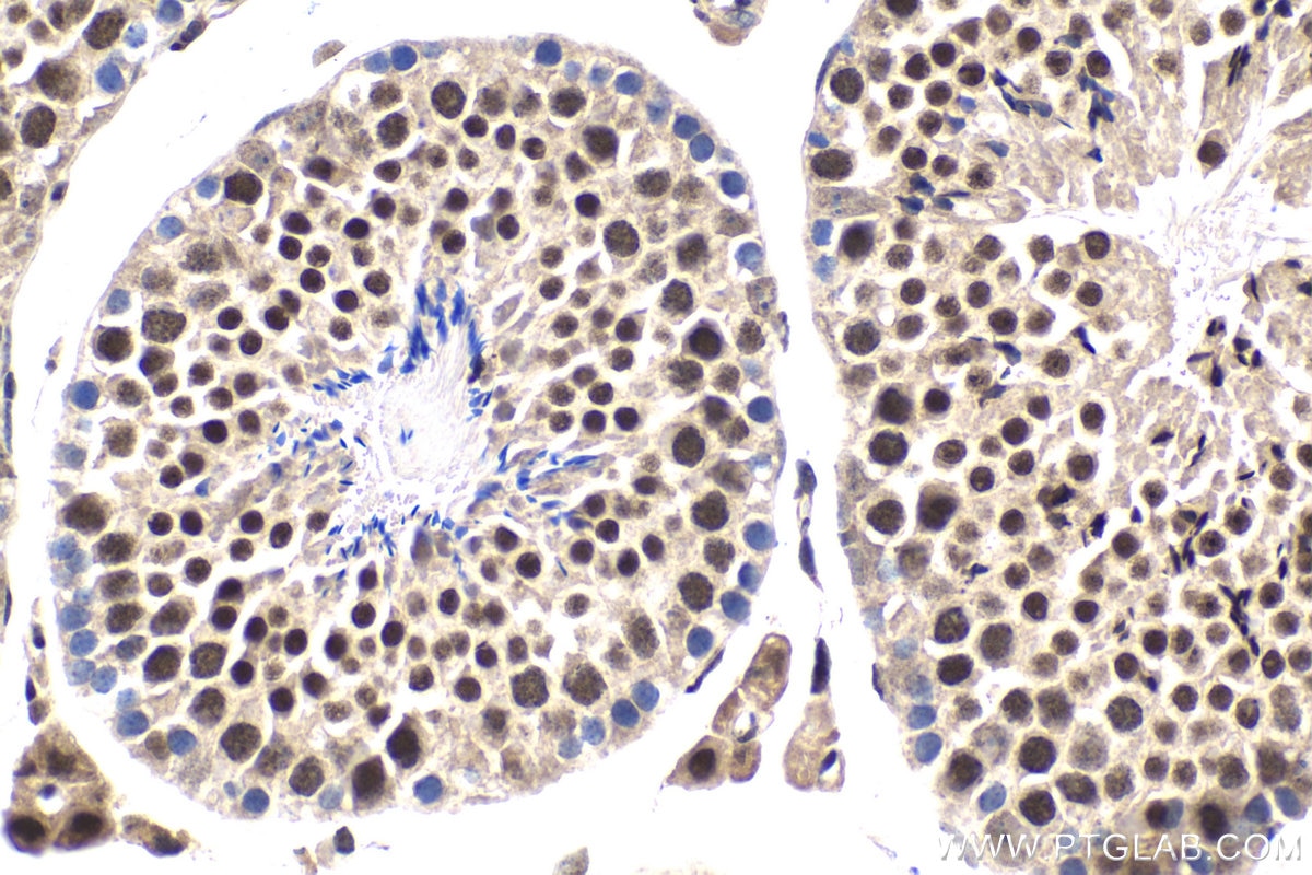 Immunohistochemical analysis of paraffin-embedded mouse testis tissue slide using KHC1658 (HSF1 IHC Kit).