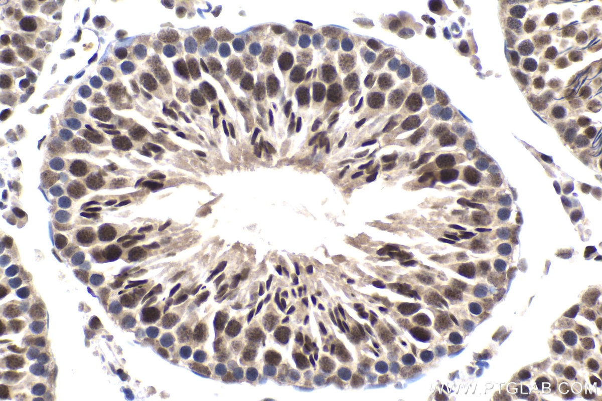 Immunohistochemical analysis of paraffin-embedded rat testis tissue slide using KHC1658 (HSF1 IHC Kit).