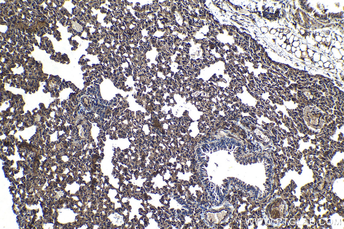 Immunohistochemical analysis of paraffin-embedded mouse lung tissue slide using KHC1241 (HSP47 IHC Kit).