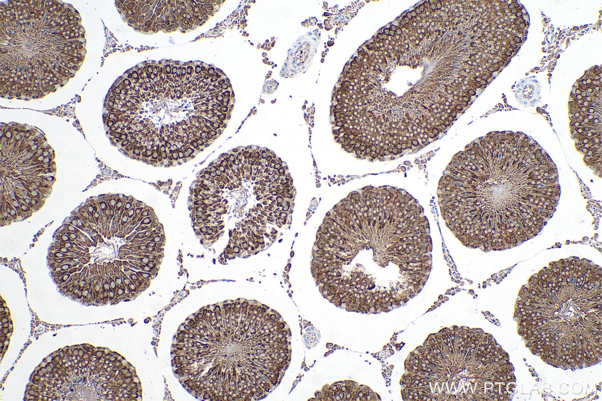 Immunohistochemical analysis of paraffin-embedded rat testis tissue slide using KHC0659 (HSP90AA1 IHC Kit).