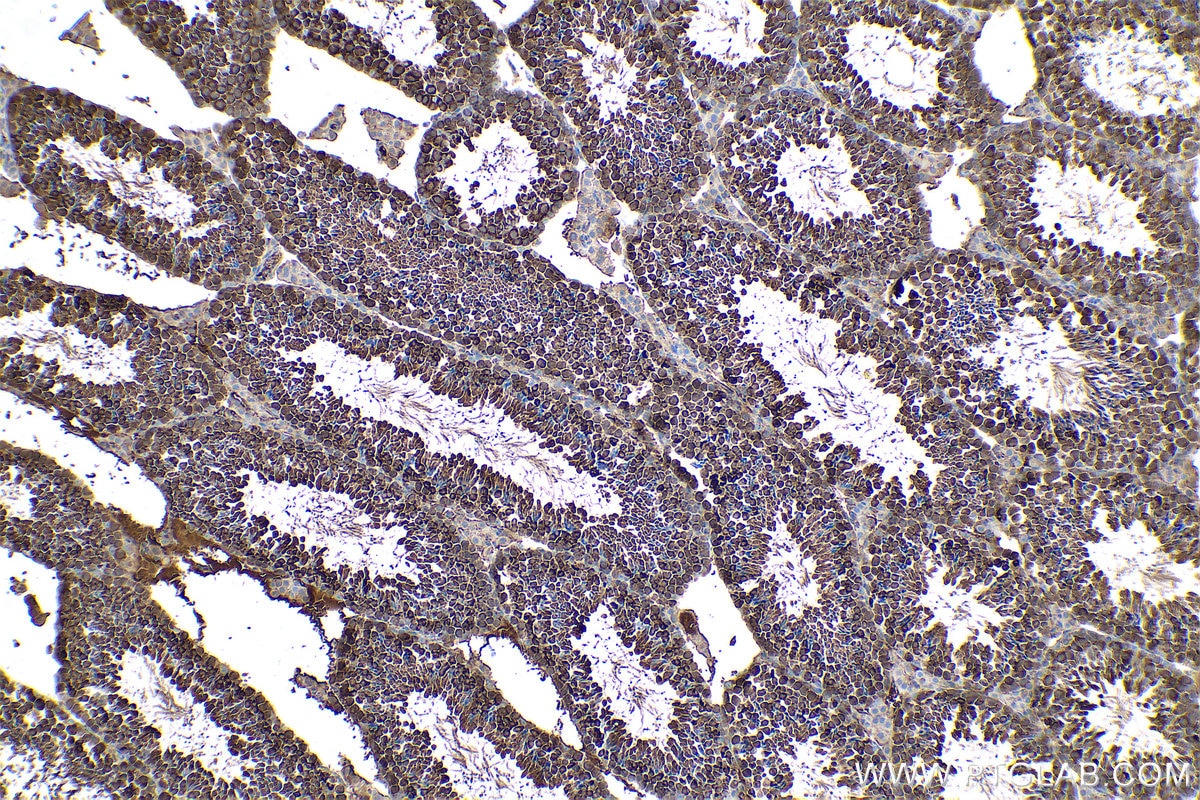 Immunohistochemical analysis of paraffin-embedded mouse testis tissue slide using KHC0659 (HSP90AA1 IHC Kit).