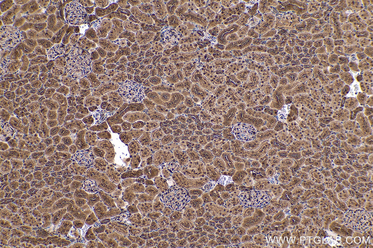 Immunohistochemical analysis of paraffin-embedded rat kidney tissue slide using KHC0564 (HSP90AB1 IHC Kit).