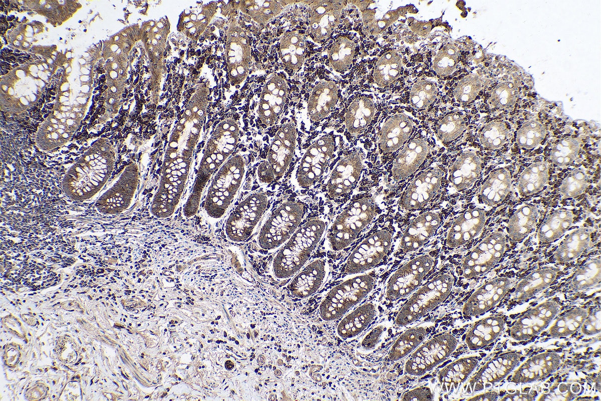 Immunohistochemical analysis of paraffin-embedded human colon tissue slide using KHC0626 (HSPA13 IHC Kit).